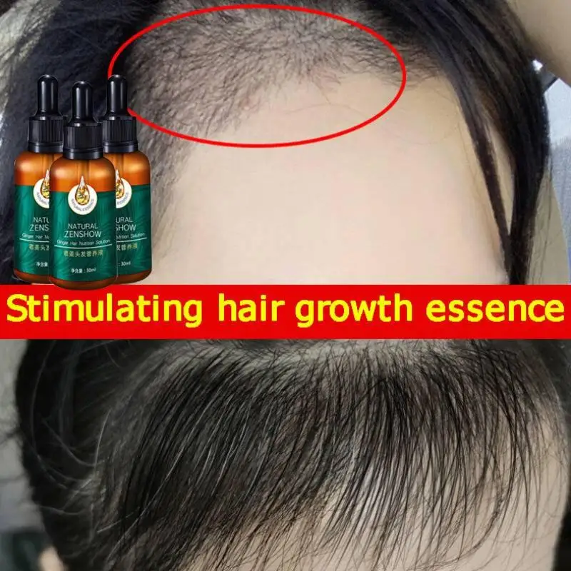 Ginger Hair Growth Essential O - огляд і ціна Hair Care Herbal Products