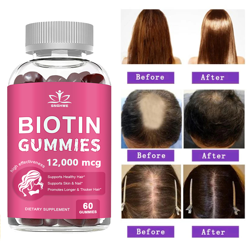 Collagen Gummies Biotin Gummie - огляд і ціна Hair Care Gummies